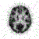 Example of reconstructed brain image